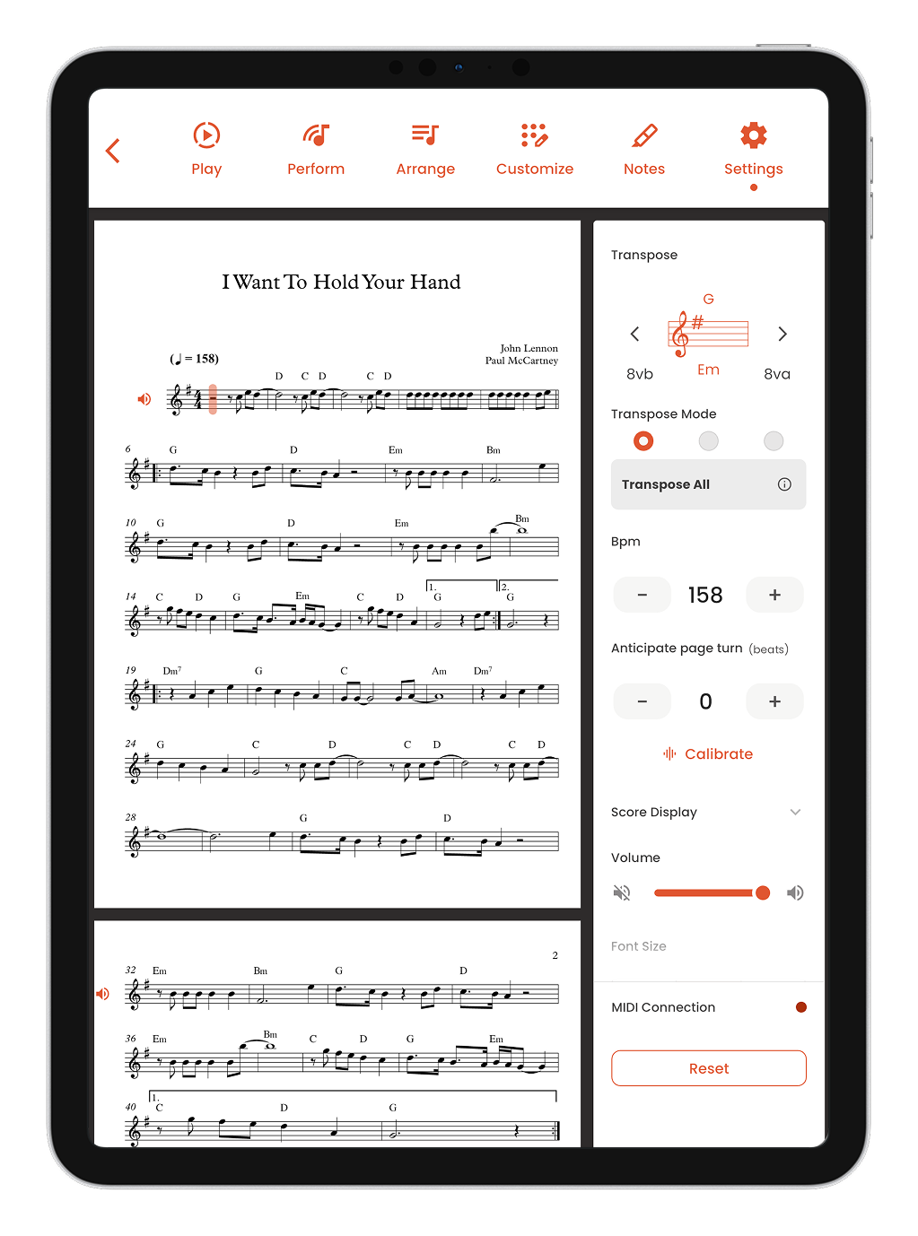 Musiway on iPad: a score open next to the settings panel, with transpose, BPM, page-turn anticipation and score display